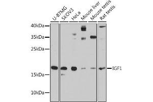 Western blot analysis of extracts of various cell lines, using IGF1 antibody (ABIN6134370, ABIN6142231, ABIN6142233 and ABIN6215544) at 1:3000 dilution. (IGF1 anticorps  (AA 50-150))