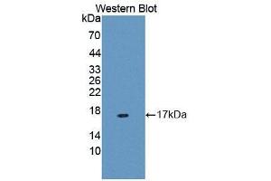 Western blot analysis of the recombinant protein. (MUC5B anticorps  (AA 5366-5444))