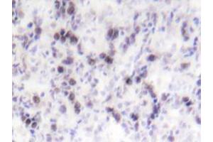 Immunohistochemistry analyzes of CREB antibody in paraffin-embedded human tonsil tissue. (CREB1 anticorps)