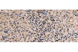 Immunohistochemistry of paraffin-embedded Human brain tissue using ITIH2 Polyclonal Antibody at dilution of 1:70(x200) (ITIH2 anticorps)