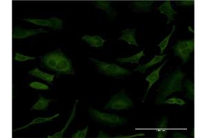 Immunofluorescence of monoclonal antibody to SFN on HeLa cell. (14-3-3 sigma/SFN anticorps  (AA 1-248))