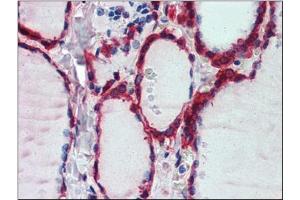 Immunohistochemistry: Human Thyroid: Formalin-Fixed, Paraffin-Embedded (FFPE) (Peroxiredoxin 1 anticorps  (Internal Region))
