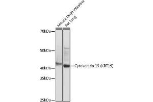Western blot analysis of extracts of various cell lines, using Cytokeratin 19 (KRT19) (KRT19) antibody (ABIN7268099) at 1:1000 dilution. (Cytokeratin 19 anticorps)