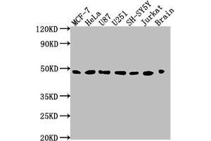 Western Blot Positive WB detected in: MCF-7 whole cell lysate, HeLa whole cell lysate, U87 whole cell lysate, U251 whole cell lysate, SH-SY5Y whole cell lysate, Jurkat whole cell lysate, Rat brain tissue All lanes: LOX antibody at 1:2000 Secondary Goat polyclonal to rabbit IgG at 1/50000 dilution Predicted band size: 47 kDa Observed band size: 47 kDa (LOX anticorps  (AA 23-285))