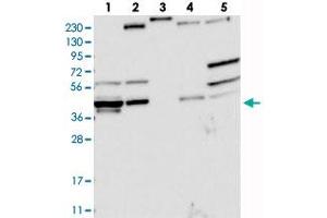 Western blot analysis of Lane 1: RT-4, Lane 2: U-251 MG, Lane 3: Human Plasma, Lane 4: Liver, Lane 5: Tonsil with AGPAT9 polyclonal antibody .
