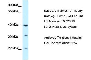 Western Blotting (WB) image for anti-Galactokinase 1 (GALK1) (C-Term) antibody (ABIN786519) (GALK1 anticorps  (C-Term))