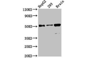 Western Blot Positive WB detected in: HepG2 whole cell lysate, 293 whole cell lysate, Mouse brain tissue All lanes: ZFP57 antibody at 13. (ZFP57 anticorps  (AA 183-295))