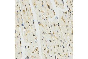 Immunohistochemistry (IHC) image for anti-Myb-Like, SWIRM and MPN Domains 1 (MYSM1) (C-Term) antibody (ABIN3017376) (MYSM1 anticorps  (C-Term))