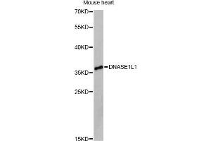 Western blot analysis of extracts of mouse heart, using DNASE1L1 Antibody (ABIN6292459) at 1:3000 dilution. (DNASEX anticorps)