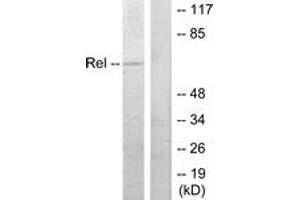 Western blot analysis of extracts from MDA-MB-435 cells, using Rel (Ab-503) Antibody. (c-Rel anticorps  (AA 470-519))