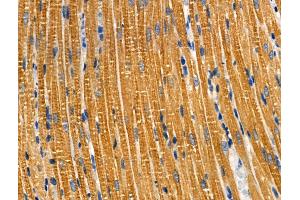 ABIN6259163 and ABIN6274159 at 1/100 staining Rat heart tissue by IHC-P. (TACSTD2 anticorps  (Internal Region))