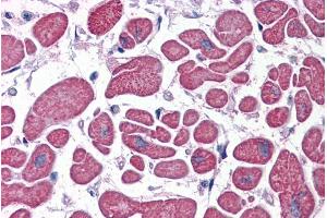 ABIN185530 (5µg/ml) staining of paraffin embedded Human Heart. (PDE4D anticorps  (C-Term))