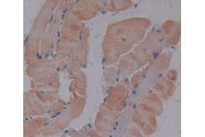 IHC-P analysis of Mouse Tissue, with DAB staining. (TNNI1 anticorps  (AA 1-187))