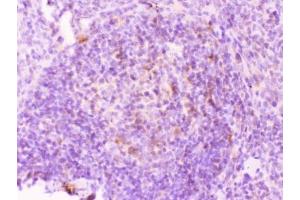 IHC testing of FFPE rat spleen tissue with MMP11 antibody at 1ug/ml.