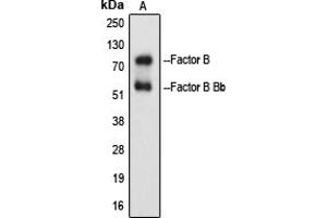 Western blot analysis of Factor B Bb expression in Raji Etoposide-treated (A) whole cell lysates. (Complement B + Bb (Center) anticorps)