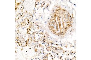 Immunohistochemistry of paraffin-embedded human lung using BST2 Rabbit pAb (ABIN6129547, ABIN6137673, ABIN6137675 and ABIN6215924) at dilution of 1:100 (40x lens).