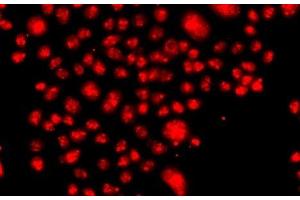 Immunofluorescence analysis of A549 cells using FANCM Polyclonal Antibody (FANCM anticorps)