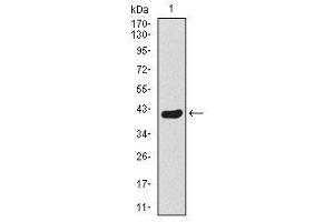 Image no. 1 for anti-Twist Homolog 1 (Drosophila) (TWIST1) antibody (ABIN1491700)