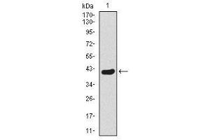 Image no. 1 for anti-Twist Homolog 1 (Drosophila) (TWIST1) antibody (ABIN1491700) (TWIST1 anticorps)