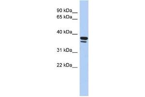 WB Suggested Anti-EGR3 Antibody Titration:  0. (EGR3 anticorps  (Middle Region))