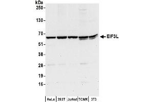 anti-Eukaryotic Translation Initiation Factor 3, Subunit L (EIF3L) (AA 1-50) antibody