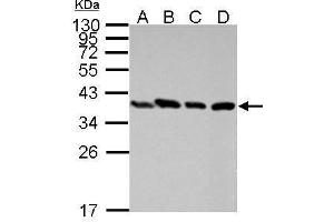 WB Image Sample (30 ug of whole cell lysate) A: Raji B: K562 C: THP-1 D: NCI-H929 12% SDS PAGE antibody diluted at 1:10000