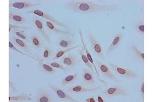 Immunocytochemistry analysis of Hela cells using ABIN7139153 at dilution of 1:100