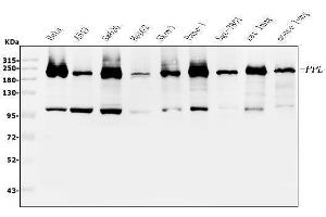 Western blot analysis of Periplakin using anti-Periplakin antibody (ABIN5518787). (PPL anticorps  (C-Term))