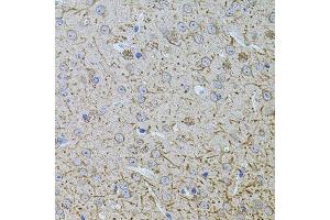 Immunohistochemistry of paraffin-embedded mouse brain using TEFM antibody. (TEFM anticorps  (AA 36-210))