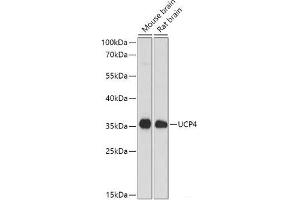 Western blot analysis of extracts of various cell lines using SLC25A27 Polyclonal Antibody at dilution of 1:1000. (SLC25A27 anticorps)
