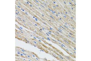 Immunohistochemistry of paraffin-embedded mouse heart using MYOT antibody (ABIN5973839) at dilution of 1/100 (40x lens). (Myotilin anticorps)