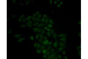 Immunofluorescence analysis of MCF-7 cells using CTSE antibody. (Cathepsin E anticorps)