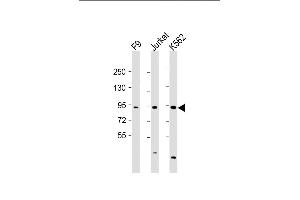 All lanes : Anti-NUP93 Antibody (N-Term) at 1:2000 dilution Lane 1: F9 whole cell lysate Lane 2: Jurkat whole cell lysate Lane 3: K562 whole cell lysate Lysates/proteins at 20 μg per lane. (NUP93 anticorps  (AA 20-54))