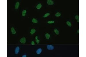 Immunofluorescence analysis of U-2 OS cells using MKL1 Polyclonal Antibody at dilution of 1:100 (40x lens).