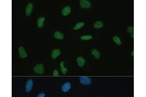 Immunofluorescence analysis of U-2 OS cells using MKL1 Polyclonal Antibody at dilution of 1:100 (40x lens). (MKL1 anticorps)