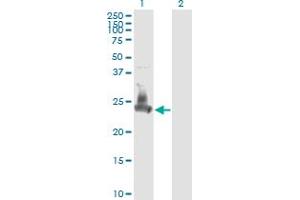 Western Blot analysis of SNAP23 expression in transfected 293T cell line by SNAP23 monoclonal antibody (M01), clone 2F5-3D4.