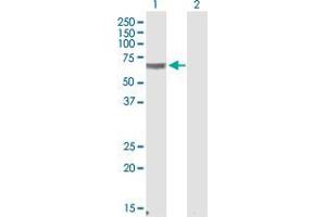 Western Blot analysis of CRAT expression in transfected 293T cell line by CRAT polyclonal antibody (A01).
