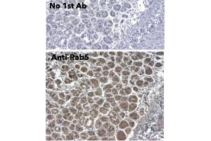 Immunohistochemistry (IHC) image for anti-RAB5A, Member RAS Oncogene Family (RAB5A) (C-Term) antibody (ABIN1440056)