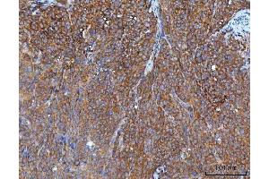 IHC analysis of IMPDH2 using anti-IMPDH2 antibody (ABIN7603063).