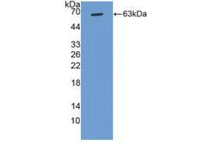 Western blot analysis of recombinant Human CCND1. (Cyclin D1 anticorps  (AA 1-295))