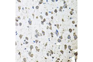 Immunohistochemistry of paraffin-embedded mouse brain using FGF1 antibody at dilution of 1:100 (x40 lens). (FGF1 anticorps)