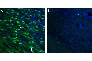 Expression of ACE2 in mouse thalamus. (ACE2 anticorps  (Extracellular))