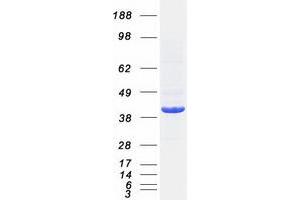 Validation with Western Blot