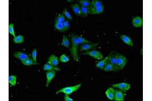 Immunofluorescent analysis of HepG2 cells using ABIN7171394 at dilution of 1:100 and Alexa Fluor 488-congugated AffiniPure Goat Anti-Rabbit IgG(H+L)