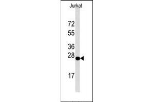 anti-DNA-Damage-Inducible Transcript 4 (DDIT4) (C-Term), (N-Term) antibody