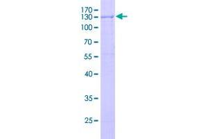 Image no. 1 for Receptor-Interacting Serine-threonine Kinase 4 (RIPK4) (AA 1-784) protein (GST tag) (ABIN2866319)