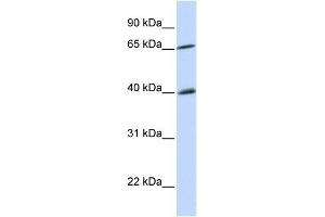 WB Suggested Anti-CHEK2 Antibody Titration:  0. (CHEK2 anticorps  (N-Term))