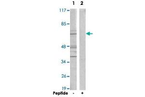 Western blot analysis of extracts from A-549 cells, using CERKL polyclonal antibody . (CERKL anticorps)
