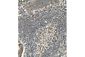 IHC analysis of SGK1 using anti-SGK1 antibody (ABIN7603118). (SGK1 anticorps  (N-Term))