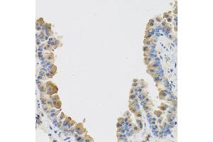 Immunohistochemistry of paraffin-embedded mouse lung using IL25 antibody at dilution of 1:100 (40x lens). (IL-25 anticorps)